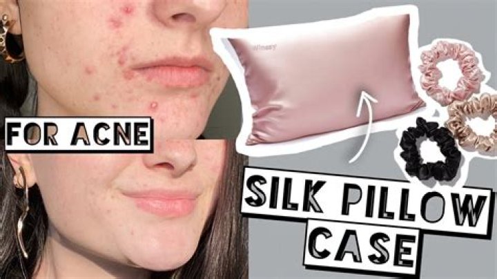 Can dirty pillow cause acne?