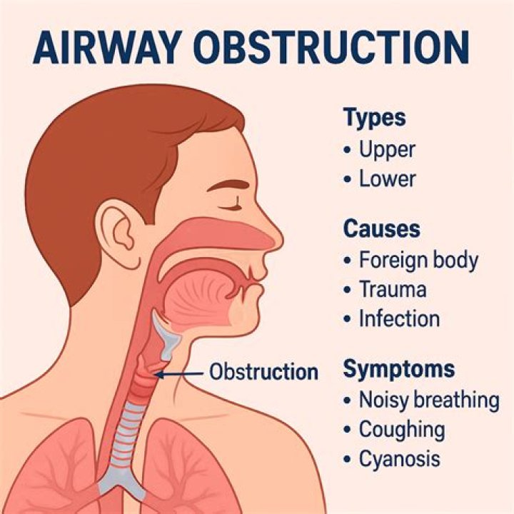 Is gurgling upper or lower airway?
