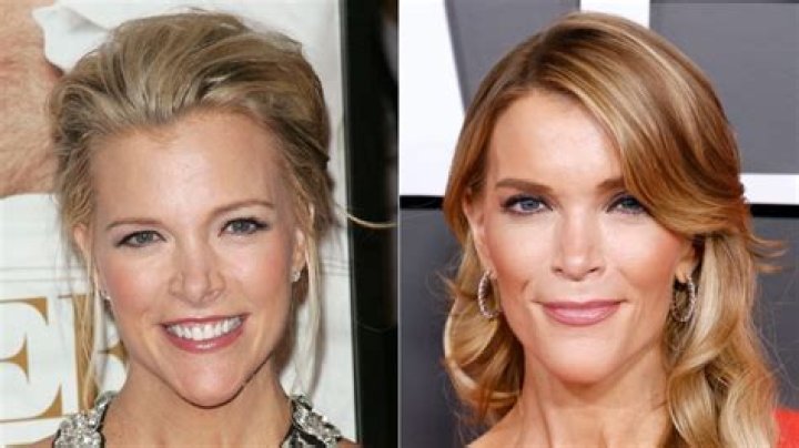 Megyn Kelly Facelift Did She Get Plastic Surgery? Before And After Pics And Age |