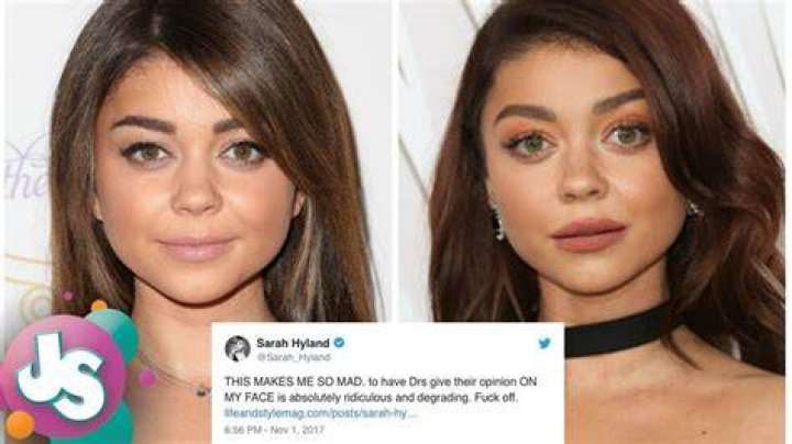 The Truth Behind Sarah Hyland Plastic Surgery