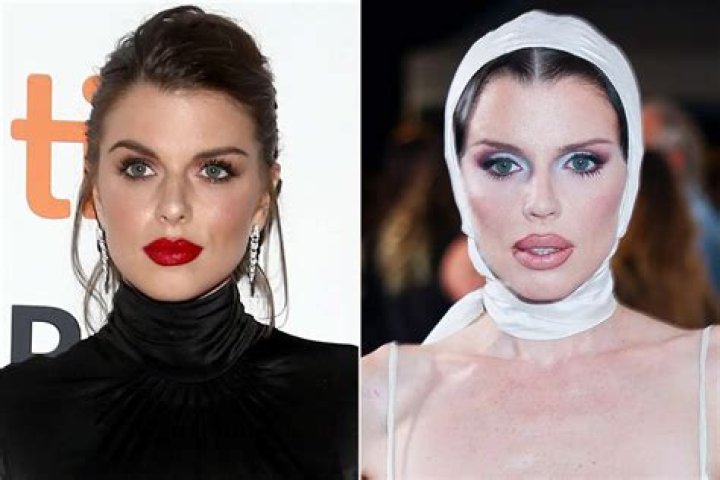 Unveiling Karol G's Plastic Surgery Journey: Discoveries And Insights